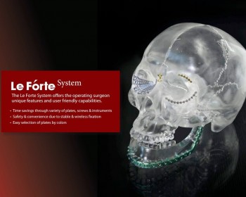 <p>Sistema de osteosíntesis maxilofacial de diámetros 1.2/1.6/2.0/2.4 y 2.0/2.4 bloqueados&nbsp;</p>